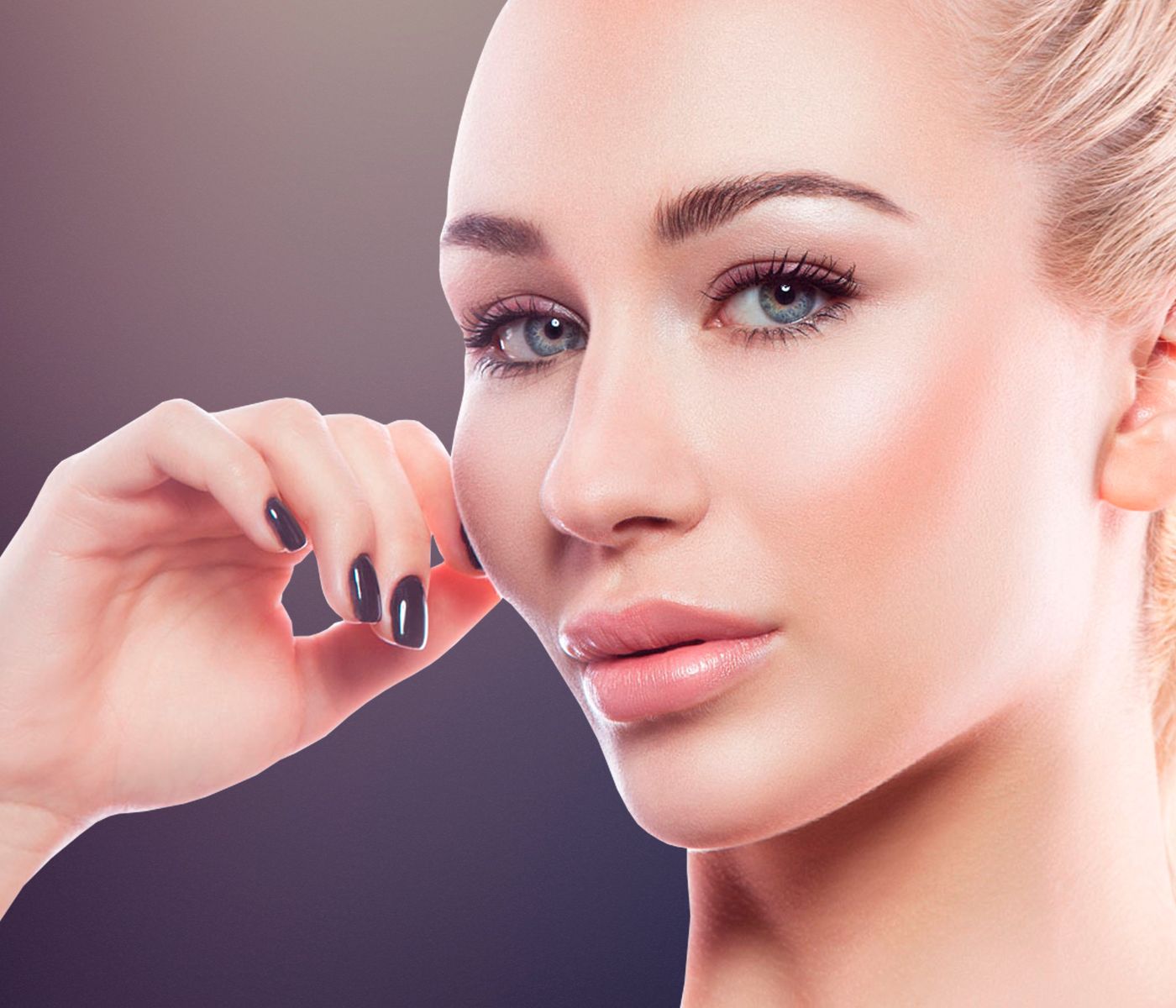 Revision rhinoplasty at Dr. Solomon's clinic